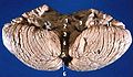 Human cerebellum anterior view