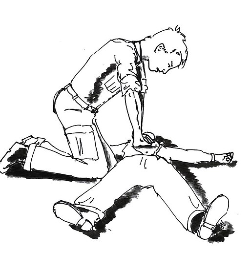 Illustration of cardiopulmonary resuscitation