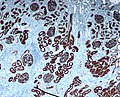 正常腎臟的CD10免疫組化染色。 CD10漬近曲小管和腎小球。