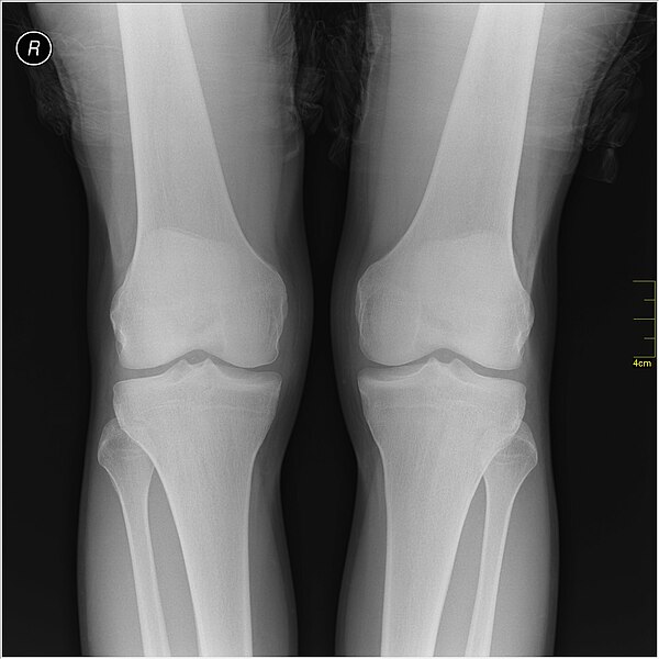 File:Medical X-Ray imaging RDF06 nevit.jpg