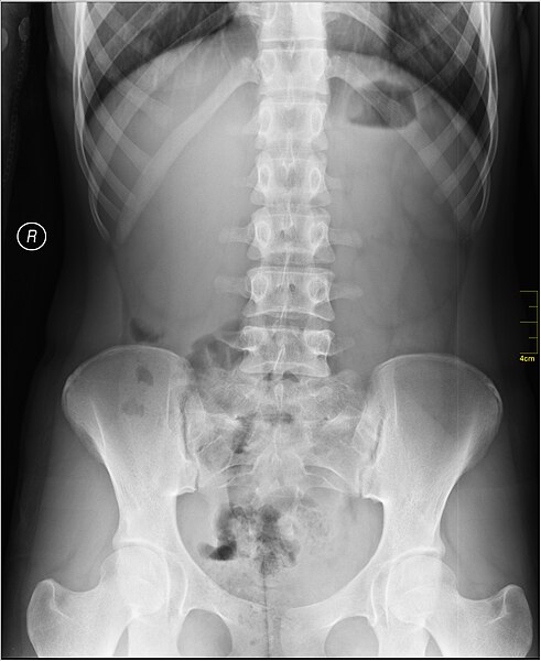 File:Medical X-Ray imaging VVO07 nevit.jpg