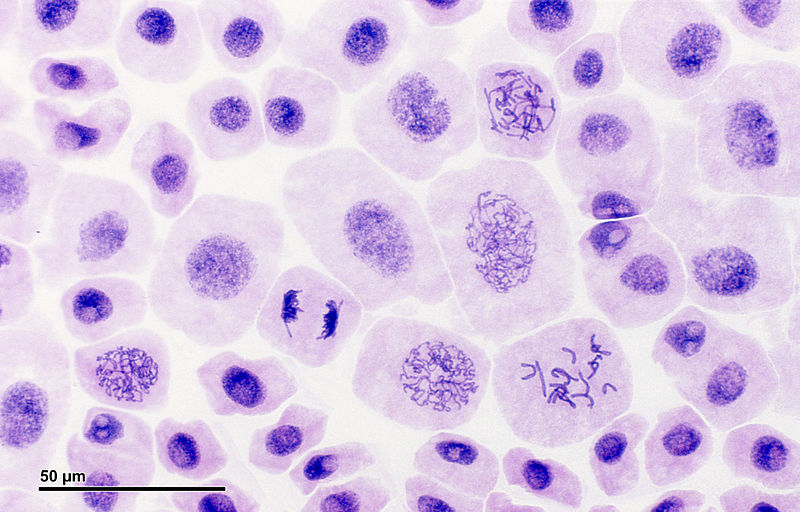 Stained actively dividing cells of onion root tip