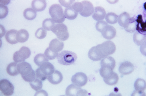 Beskrivelse av bildet Plasmodium_ovale_01.png.