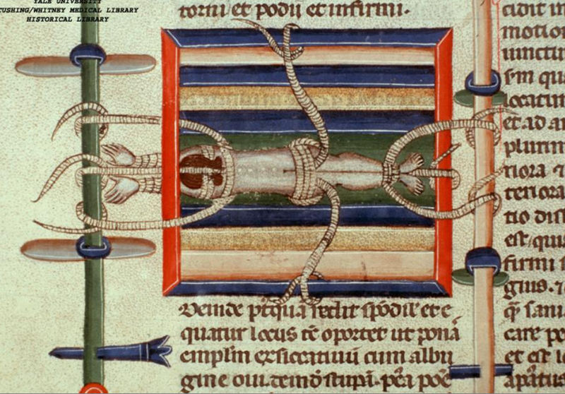 File:Reduce dislocated spine, c. 1300.jpg