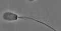 File:Self-Sustained-Oscillatory-Sliding-Movement-of-Doublet-Microtubules-and-Flagellar-Bend-Formation-pone.0148880.s003.ogv