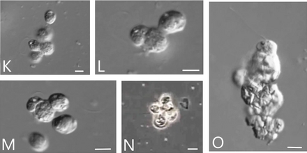 K-M, O: cellular aggregations of Syssomonas near the bottom of the Petri dish. N: floating aggregate of flagellated cells. Syssomonas aggregates.webp