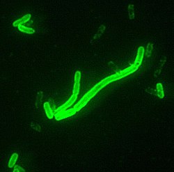 Fluoreszcensen jelölt Yersinia pestis baktérium, a pestis kórokozója (200-szoros nagyításban)