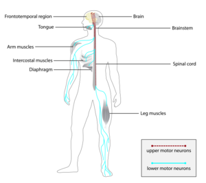 Diagram of a human nervous system highlighting the brain, spinal cord, motor neurons, and muscles of the body affected by ALS