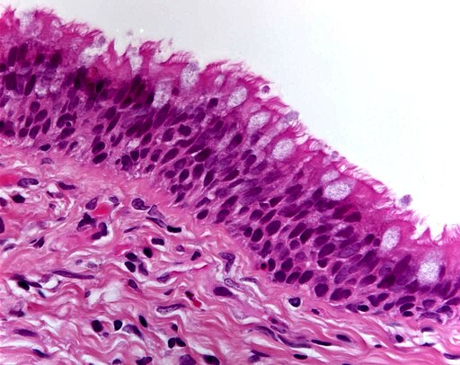 Ciliated columnar epithelium