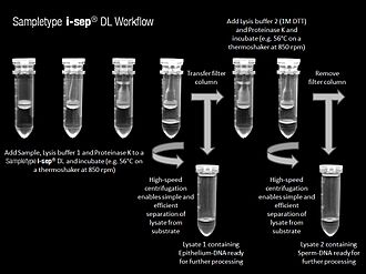 Workflow of the differential lysis of a sample of sexual assault evidence is shown. All steps of the stepwise DNA-extraction process are described in detail. Differential lysis in a single-tube extraction process for accurate forensic profiling.jpg