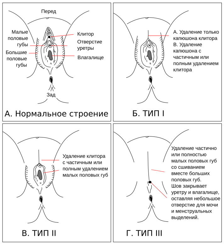 Большие Половы Губы Фото