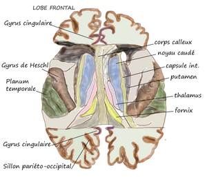 Diagram labeling planum temporale in green. Face sup T1.png