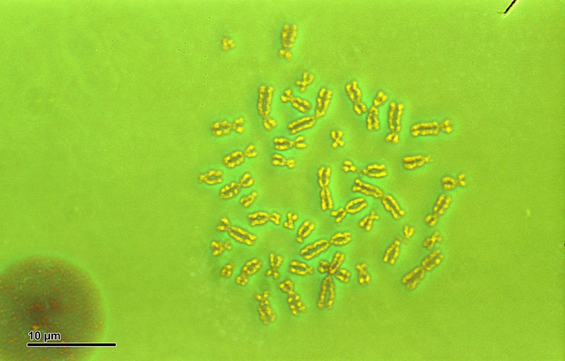 File:Human karyotype (259 36) Karyotype Human 46,XY (man).jpg