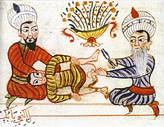 Circumcision, from the Cerrahiyetü'l Haniyye (Surgeries for Health) by Sabuncuoğlu Şerafeddin (c. 1450)