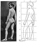 Stratz - child's body 13.jpg