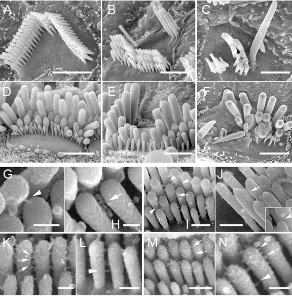 File:The Tailchaser mutation does not affect formation of interstereocilial links.png