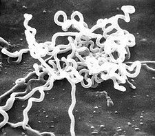 Treponema pallidum, původce syfilidy