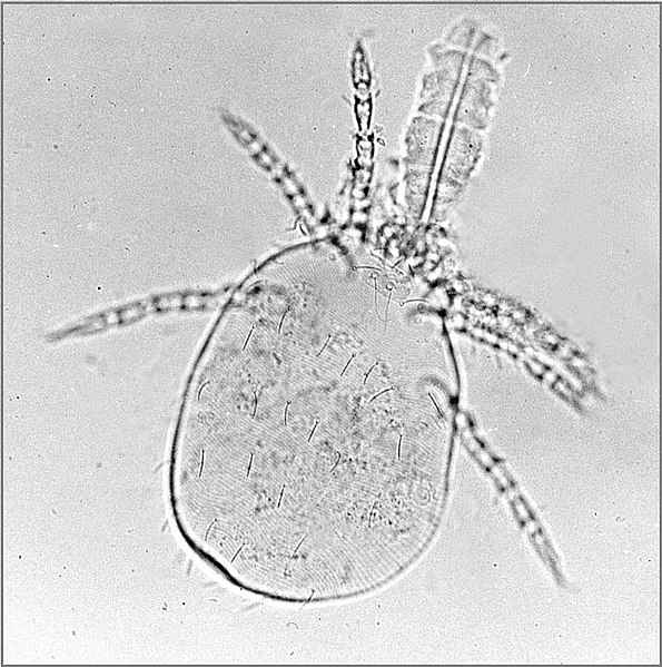 File:Trombicula-mite-larva-with stylostome-2.jpg