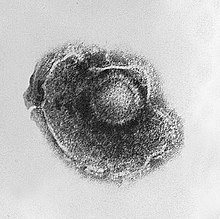 Electron micrograph of a "Human alphaherpesvirus 3" virus