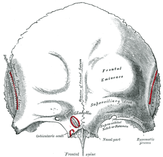 Frontal eminence Rounded elevation of the frontal bone of the skull