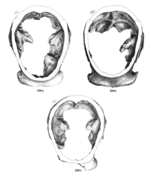 Cross sections of Peking Man Skulls III (A) and XII (B), and Java Man Skull II (C) Homo erectus skull cross-section.png