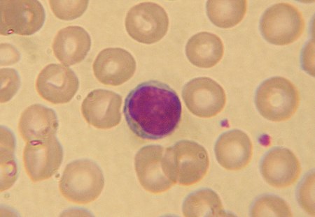 ไฟล์:Lymphocyte2.jpg