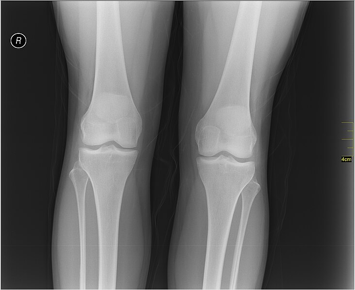 File:Medical X-Ray imaging RNG07 nevit.jpg