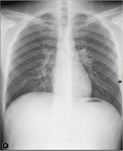 File:Medical X-Ray imaging SJZ07 nevit.jpg