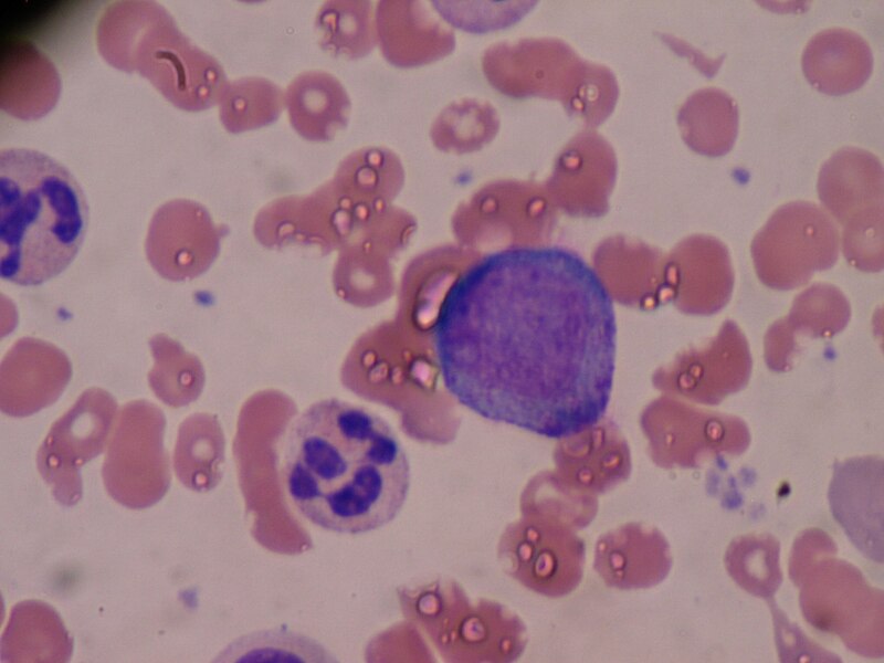 File:Promyelocyte.JPG