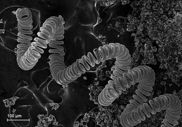 A scanning electron microscope image of the tungsten filament of an incandescent light bulb