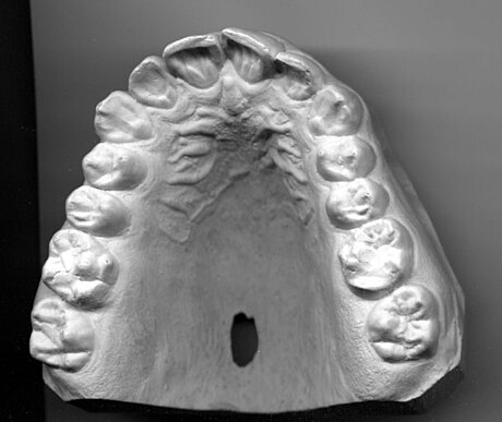 Dentition