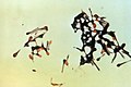 Das Bakterium vergrößert unter dem Mikroskop