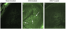 Laurel extract treatment reduces infiltration by CD4+ T-cells in DSS-treated mice.