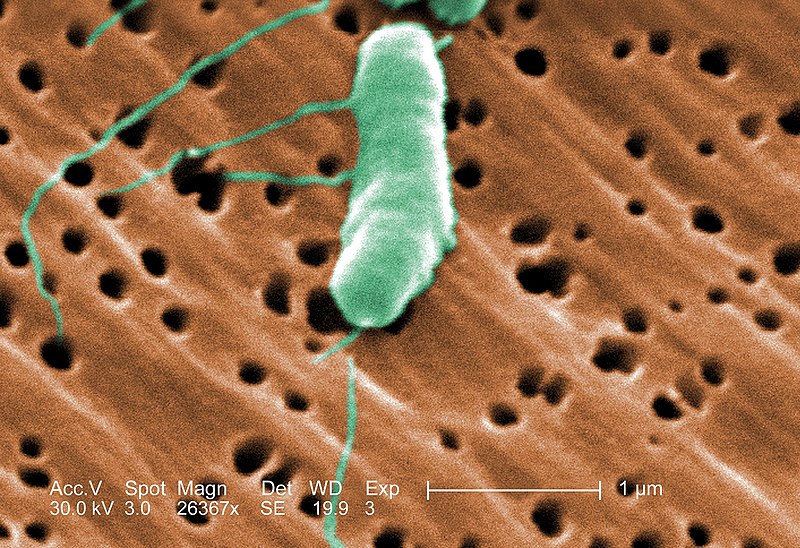 File:Flagellated Vibrio Vulnificus Bacterium - Colorized Scanning Electron Micrograph (SEM) - cdc.gov - 1576 x 1080.jpg