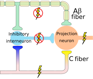 The firing of the projection neuron determines pain. The inhibitory interneuron decreases the chances that the projection neuron will fire. Firing of C fibers inhibits the inhibitory interneuron (indirectly), increasing the chances that the projection neuron will fire. Inhibition is represented in blue, and excitation in yellow. A lightning bolt signifies increased neuron activation, while a crossed-out bolt signifies weakened or reduced activation. Gate control no A.svg