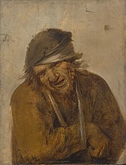 A peasant grimacing with his arm in a sling