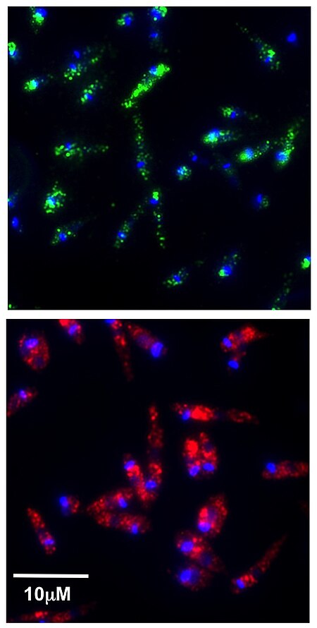 Leishmania RNA virus (dsRNA,capsid).jpg