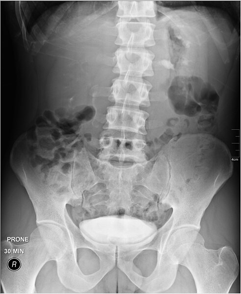 File:Medical X-Ray imaging DBI03 nevit.jpg