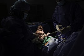 Newborn in the operating room