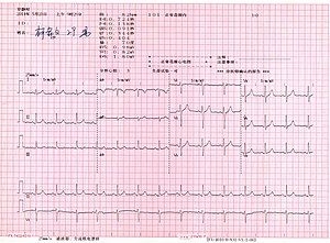 Electrocardiography