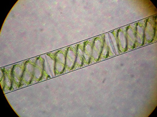 Spirogyra