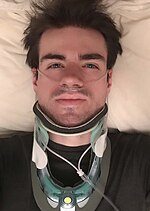 Thumbnail for Cervical collar