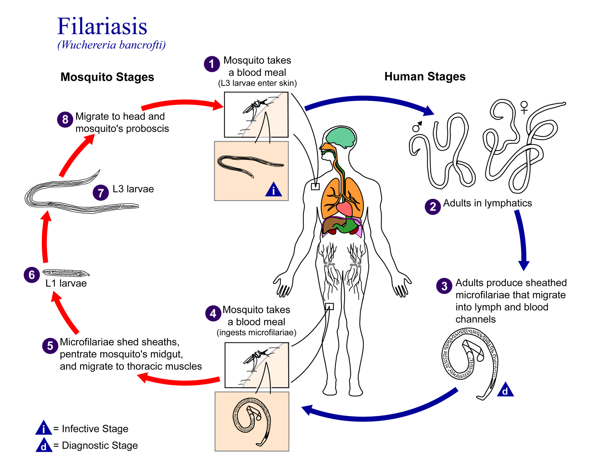 Filariasis - Wikipedia bahasa Indonesia, ensiklopedia bebas