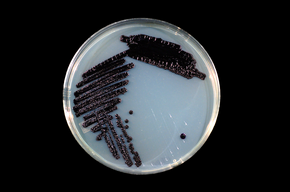 Description de l'image Janthinobacterium_lividum_on_TY.png.