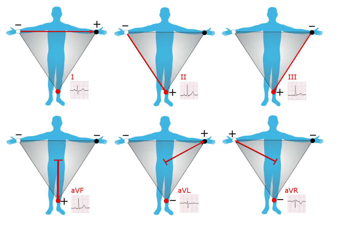 Triángulo de Einthoven