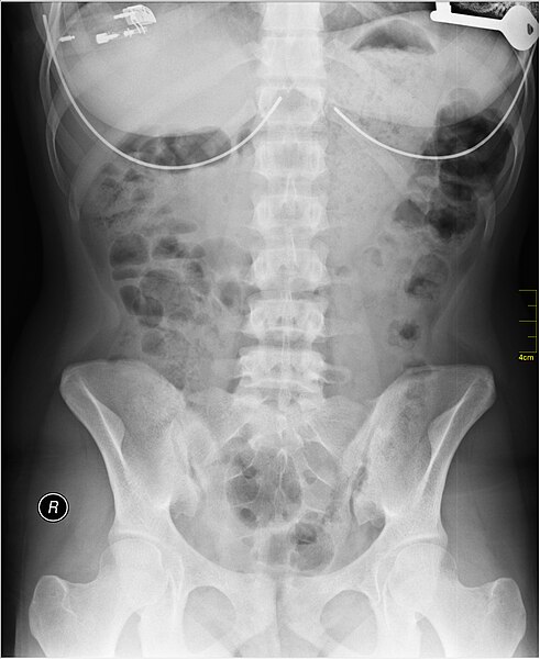 File:Medical X-Ray imaging OQF06 nevit.jpg