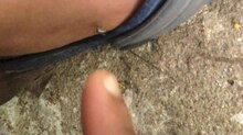 Fil: Mosquito biting on leg.webm