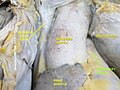 Pulmonary trunk