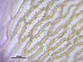 Zellen Astblattbasis dorsal