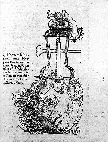 File:Trepanation, from, 'Chirurgia' Wellcome L0016870.jpg